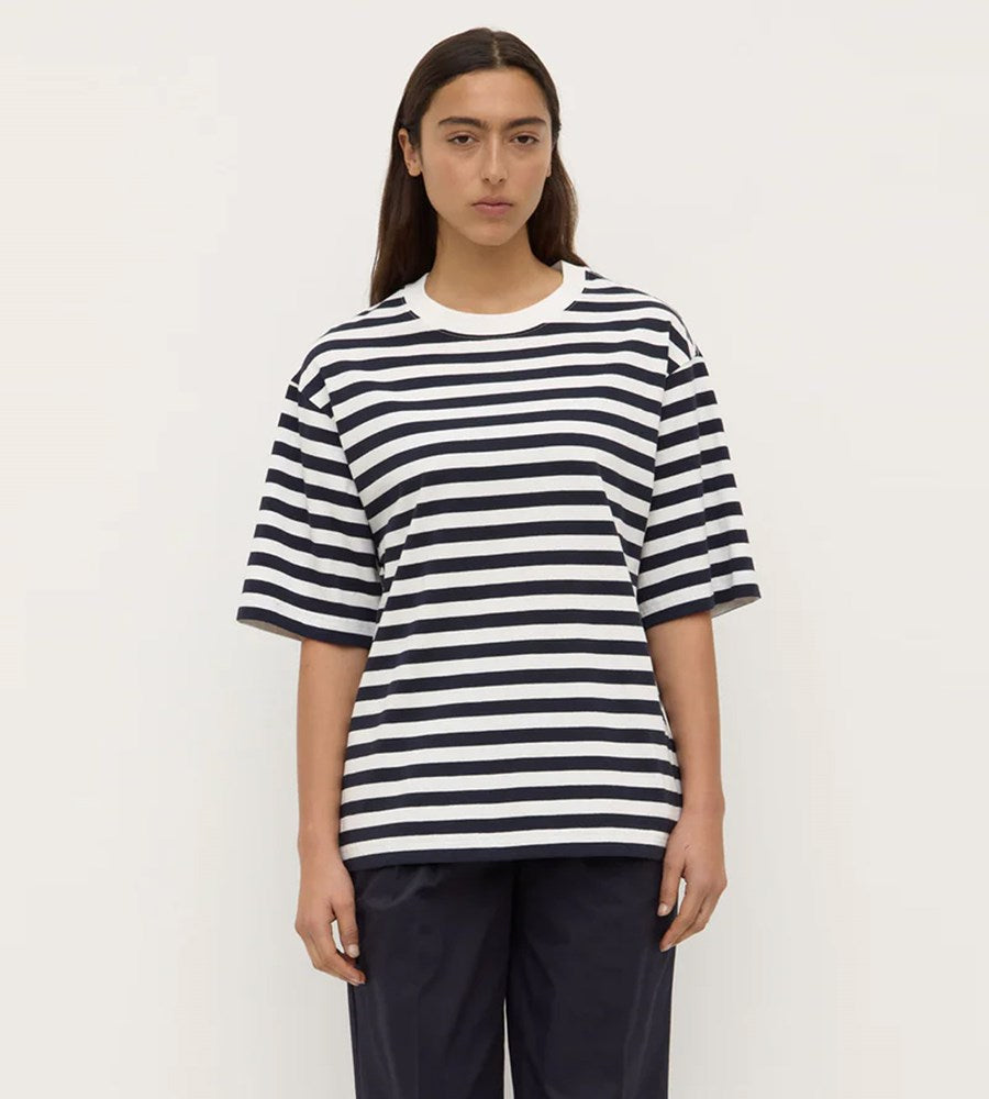 Person wearing a black and white striped shirt on a plain background